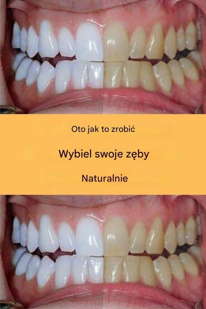 FB IMG
