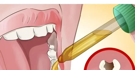 Des remedes naturels contre le mal de dents.jpg